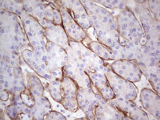 m04999 anti laminin alpha 4 lama4 mouse monoclonal antibody clone id oti5g8 ihc testing 9