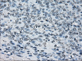 m05000 anti peroxiredoxin 4 prdx4 mouse monoclonal antibody clone id oti9a3 ihc testing 7