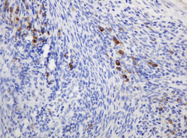 m05006 anti ribophorin ii rpn2 mouse monoclonal antibody clone id oti1g9 ihc testing 4
