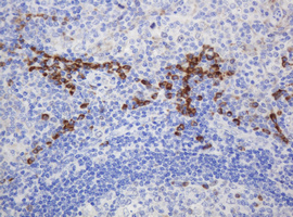 m05006 anti ribophorin ii rpn2 mouse monoclonal antibody clone id oti1g9 ihc testing 5