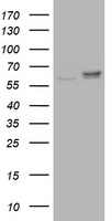 HEK293T cells were transfected with the pCMV6-ENTRY control (Left lane) or pCMV6-ENTRY RPN2 (Right lane) cDNA for 48 hrs and lysed