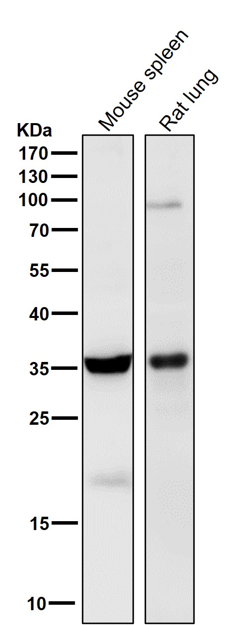 All lanes use the Antibody at 1:1K dilution for 1 hour at room temperature.