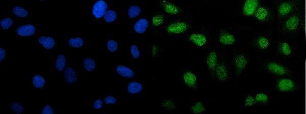m05020 1 ptbp2 primary antibodies if testing 4