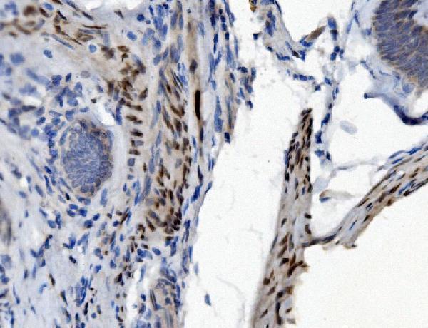 m05020 1 ptbp2 primary antibodies ihc testing 2