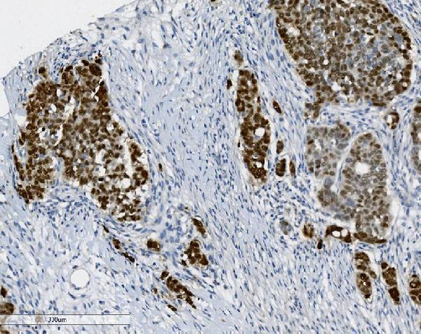 m05020 1 ptbp2 primary antibodies ihc testing 3