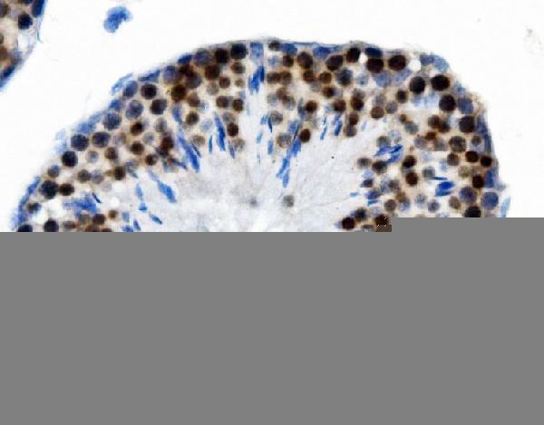 m05020 2 ptbp2 primary antibodies ihc testing 3