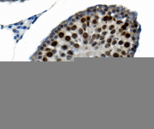 m05020 2 ptbp2 primary antibodies ihc testing 4