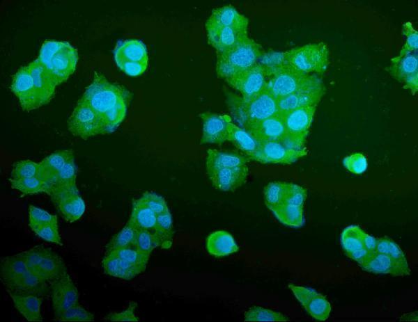 m05022 2 aldoa primary antibodies if testing 5