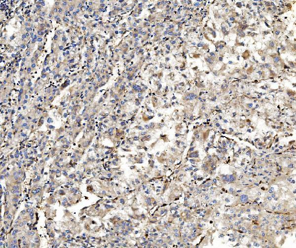  IHC analysis of Aldolase/ALDOA using anti-Aldolase/ALDOA antibody (M05022-2)