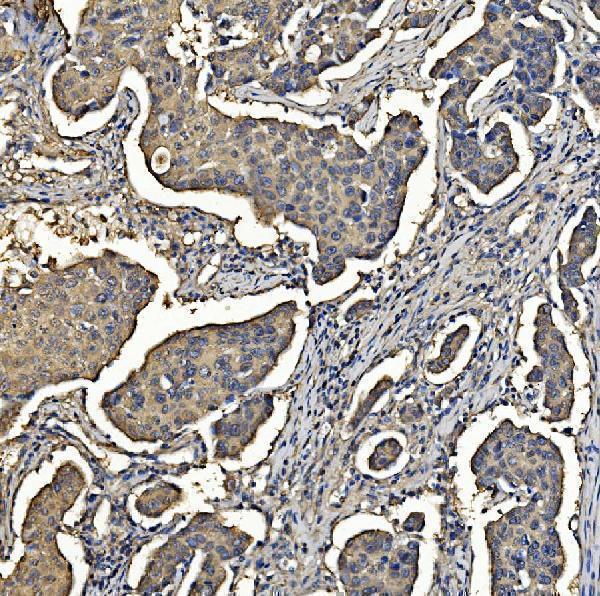  IHC analysis of Aldolase/ALDOA using anti-Aldolase/ALDOA antibody (M05022-2)