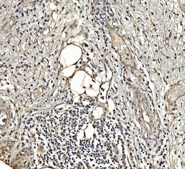 m05022 2 aldoa primary antibodies ihc testing 4