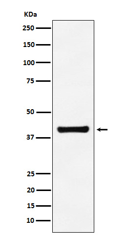 Western blot analysis of Aldolase expression in A549 cell lysate