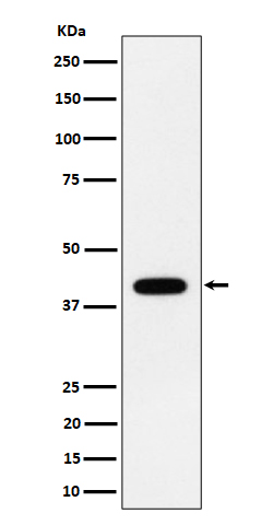 Western blot analysis of ACADS / SCAD expression in HeLa cell lysate