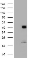 HEK293T cells were transfected with the pCMV6-ENTRY control (Left lane) or pCMV6-ENTRY ACADS (Right lane) cDNA for 48 hrs and lysed