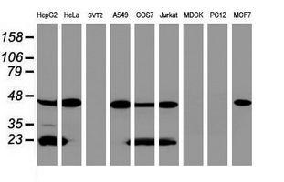 Western blot analysis of extracts (35ug) from 9 different cell lines by using anti-ACADS monoclonal antibody (HepG2: human; HeLa: human; SVT2: mouse; A549: human; COS7: monkey; Jurkat: human; MDCK: canine; PC12: rat; MCF7: human)