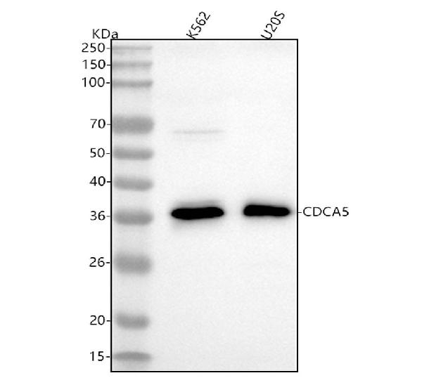 Figure 1. Western blot analysis of CDCA5 using anti-CDCA5 antibody (M05043). Electrophoresis was performed on a 5-20% SDS-PAGE gel at 70V (Stacking gel) / 90V (Resolving gel) for 2-3 hours. The sample well of each lane was loaded with 30 ug of sample under reducing conditions. Lane 1: human K562 whole cell lysates, Lane 2: human U2OS whole cell lysates. After electrophoresis, proteins were transferred to a nitrocellulose membrane at 150 mA for 50-90 minutes. Blocked the membrane with 5% non-fat milk/TBS for 1.5 hour at RT. The membrane was incubated with rabbit anti-CDCA5 antigen affinity purified monoclonal antibody (Catalog # M05043) at 1:500 overnight at 4°C, then washed with TBS-0.1%Tween 3 times with 5 minutes each and probed with a goat anti-rabbit IgG-HRP secondary antibody at a dilution of 1:500 for 1.5 hour at RT. The signal is developed using an Enhanced Chemiluminescent detection (ECL) kit (Catalog # EK1002) with Tanon 5200 system. A specific band was detected for CDCA5 at approximately 35 kDa. The expected band size for CDCA5 is at 28 kDa.