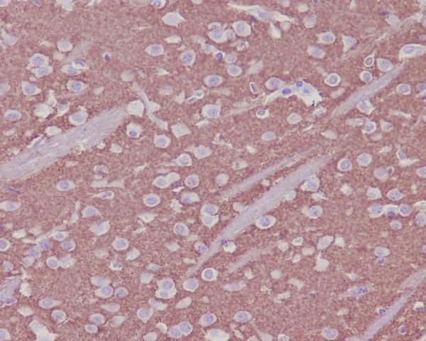 m05049 1 ihc