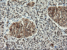 m05052 2 anti msi1 mouse monoclonal antibody clone id oti1g8 ihc testing 3