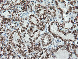 m05052 2 anti msi1 mouse monoclonal antibody clone id oti1g8 ihc testing 4