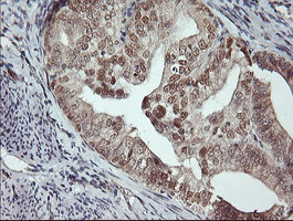 m05052 2 anti msi1 mouse monoclonal antibody clone id oti1g8 ihc testing 5