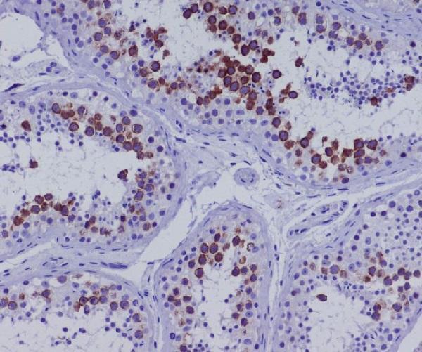 m05056 ihc