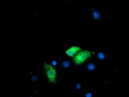 m05063 anti ribophorin i rpn1 mouse monoclonal antibody clone id oti3e1 if testing 12