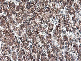 m05063 anti ribophorin i rpn1 mouse monoclonal antibody clone id oti3e1 ihc testing 10