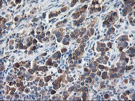 m05063 anti ribophorin i rpn1 mouse monoclonal antibody clone id oti3e1 ihc testing 4
