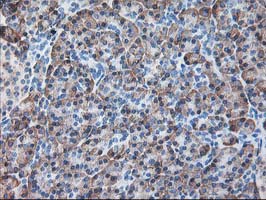 m05063 anti ribophorin i rpn1 mouse monoclonal antibody clone id oti3e1 ihc testing 5