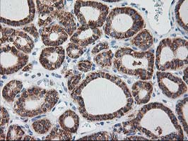 m05063 anti ribophorin i rpn1 mouse monoclonal antibody clone id oti3e1 ihc testing 6