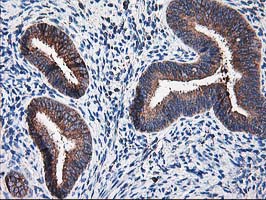 m05063 anti ribophorin i rpn1 mouse monoclonal antibody clone id oti3e1 ihc testing 7