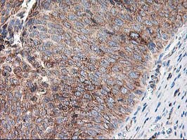m05063 anti ribophorin i rpn1 mouse monoclonal antibody clone id oti3e1 ihc testing 8