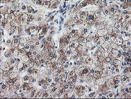 m05063 anti ribophorin i rpn1 mouse monoclonal antibody clone id oti3e1 ihc testing 9