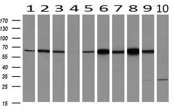 m05063 anti ribophorin i rpn1 mouse monoclonal antibody clone id oti3e1 wb testing 2