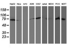 m05063 anti ribophorin i rpn1 mouse monoclonal antibody clone id oti3e1 wb testing 3