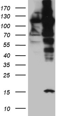 HEK293T cells were transfected with the pCMV6-ENTRY control (Left lane) or pCMV6-ENTRY IPO5 (Right lane) cDNA for 48 hrs and lysed