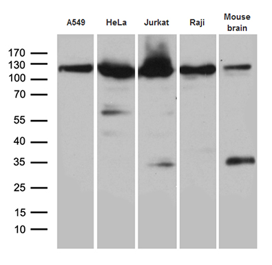 Western blot analysis of extracts (35ug) from 4 cell lines and mouse brain tissue lysate by using anti-IPO5 monoclonal antibody (1:2000)