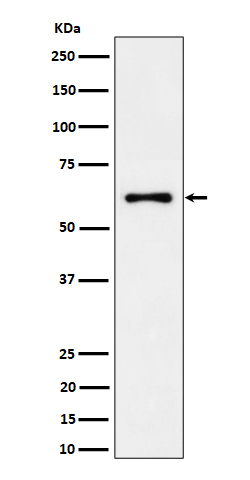 Western blot analysis of EYA2 expression in 293T cell lysate.