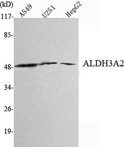 m05079 1 aldh3a2 primary antibodies wb testing 1