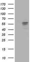 m05079 2 anti aldehyde dehydrogenase 10 aldh3a2 mouse monoclonal antibody clone id oti2a7 wb testing 1