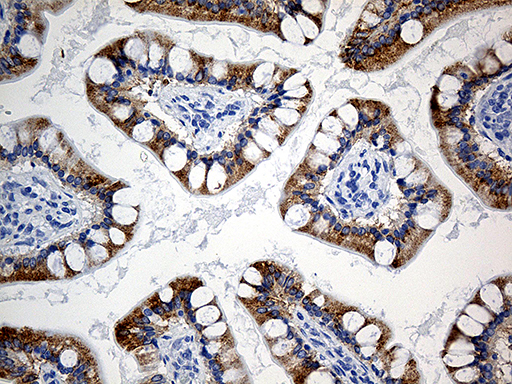 m05087 1 anti acsl5 mouse monoclonal antibody clone id oti3a3 ihc testing 2