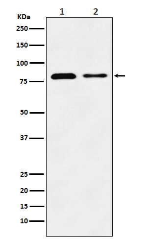 Western blot analysis of LIMPII expression in (1) HeLa cell lysate; (2) Mouse liver lysate