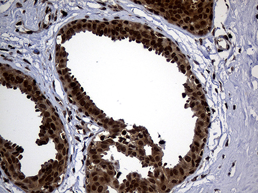 Immunohistochemical staining of paraffin-embedded Human breast tissue within the normal limits using anti-PSMA7 mouse monoclonal antibody