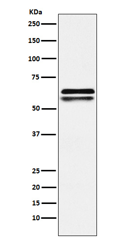 Western blot analysis of NAP1L1 expression in Jurkat cell lysate