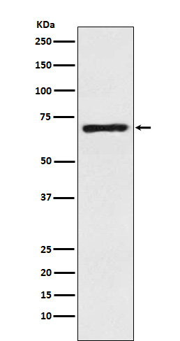 Western blot analysis of GABA Transporter 1 / GAT 1 expression in Human fetal brain lysate