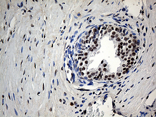 m05116 anti ube1c uba3 mouse monoclonal antibody clone id oti7h6 ihc testing 4