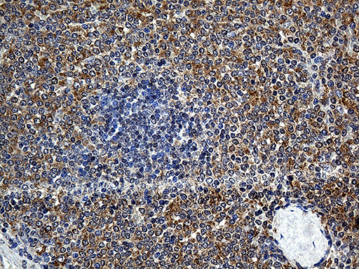 m05116 anti ube1c uba3 mouse monoclonal antibody clone id oti7h6 ihc testing 5