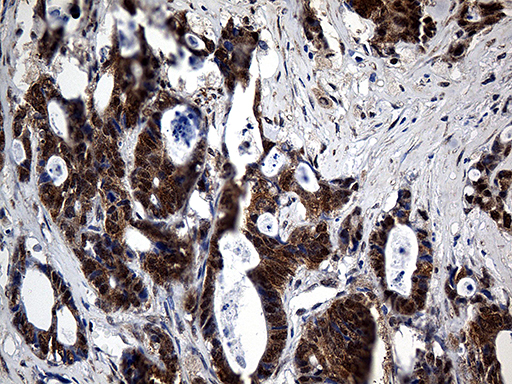 m05116 anti ube1c uba3 mouse monoclonal antibody clone id oti7h6 ihc testing 6