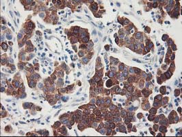 m05118 1 anti fdft1 mouse monoclonal antibody clone id oti1h9 ihc testing 5