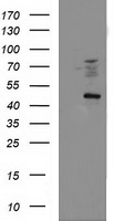 HEK293T cells were transfected with the pCMV6-ENTRY control (Left lane) or pCMV6-ENTRY FDFT1 (Right lane) cDNA for 48 hrs and lysed
